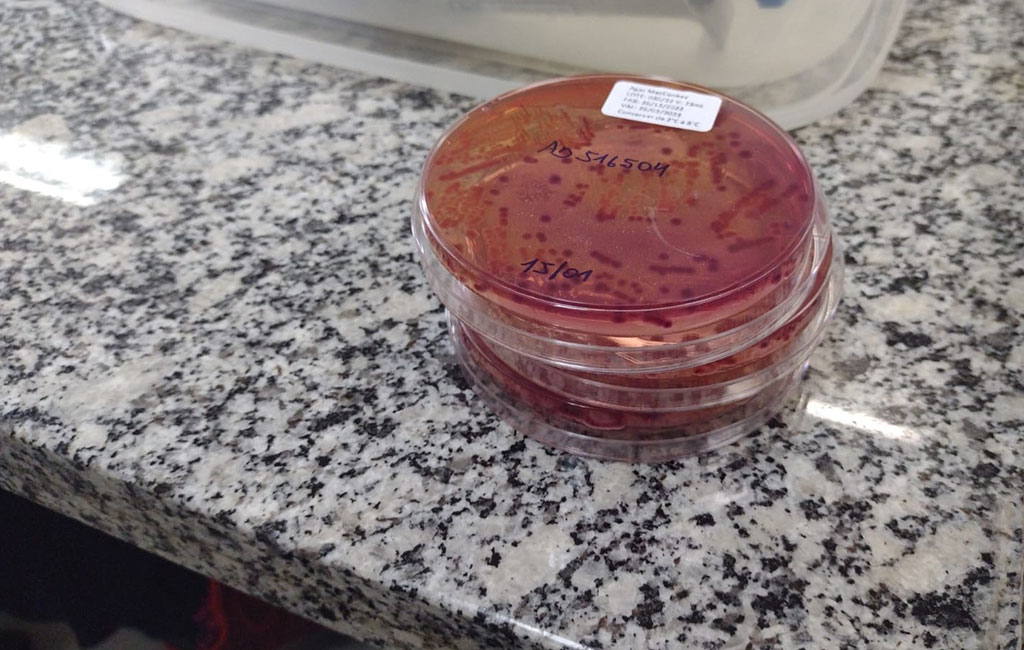 Governo do Estado amplia análise de amostras de água devido ao aumento de casos de doenças diarreicas